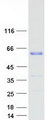 WTAP Protein - Purified recombinant protein WTAP was analyzed by SDS-PAGE gel and Coomassie Blue Staining