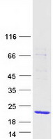 WTAP Protein - Purified recombinant protein WTAP was analyzed by SDS-PAGE gel and Coomassie Blue Staining