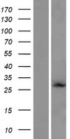 WTH3DI Protein - Western validation with an anti-DDK antibody * L: Control HEK293 lysate R: Over-expression lysate