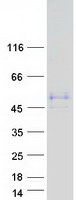 WTIP Protein - Purified recombinant protein WTIP was analyzed by SDS-PAGE gel and Coomassie Blue Staining