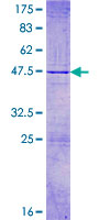 WWC1 / KIBRA Protein - 12.5% SDS-PAGE of human KIBRA stained with Coomassie Blue