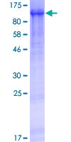 WWC2 Protein - 12.5% SDS-PAGE of human WWC2 stained with Coomassie Blue