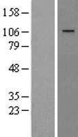 WWP1 Protein - Western validation with an anti-DDK antibody * L: Control HEK293 lysate R: Over-expression lysate