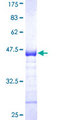 WWP1 Protein - 12.5% SDS-PAGE Stained with Coomassie Blue.