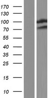 WWP2 Protein - Western validation with an anti-DDK antibody * L: Control HEK293 lysate R: Over-expression lysate