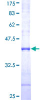 WWP2 Protein - 12.5% SDS-PAGE Stained with Coomassie Blue.