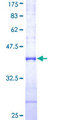 WWP2 Protein - 12.5% SDS-PAGE Stained with Coomassie Blue.