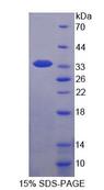 WWP2 Protein - Recombinant WW Domain Containing E3 Ubiquitin Protein Ligase 2 (WWP2) by SDS-PAGE