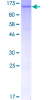 XAB2 Protein - 12.5% SDS-PAGE of human XAB2 stained with Coomassie Blue