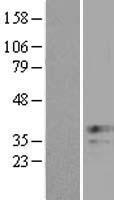 XAF1 Protein - Western validation with an anti-DDK antibody * L: Control HEK293 lysate R: Over-expression lysate