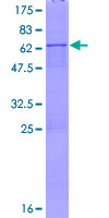 XAF1 Protein - 12.5% SDS-PAGE of human XAF1 stained with Coomassie Blue