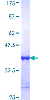 XAGE2 Protein - 12.5% SDS-PAGE Stained with Coomassie Blue.