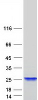 XAGE2 Protein - Purified recombinant protein XAGE2B was analyzed by SDS-PAGE gel and Coomassie Blue Staining