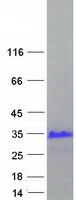 XAGE3 Protein - Purified recombinant protein XAGE3 was analyzed by SDS-PAGE gel and Coomassie Blue Staining