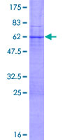 XBP1 Protein - 12.5% SDS-PAGE of human XBP1 stained with Coomassie Blue