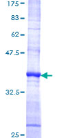 XCL1 / Lymphotactin Protein - 12.5% SDS-PAGE Stained with Coomassie Blue.