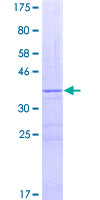 XDH / Xanthine Oxidase Protein - 12.5% SDS-PAGE Stained with Coomassie Blue.