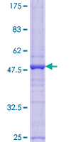 XG Protein - 12.5% SDS-PAGE of human XG stained with Coomassie Blue