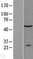 XIAP Protein - Western validation with an anti-DDK antibody * L: Control HEK293 lysate R: Over-expression lysate