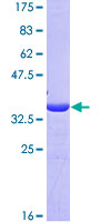 XIAP Protein - 12.5% SDS-PAGE Stained with Coomassie Blue.