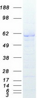 XIAP Protein - Purified recombinant protein XIAP was analyzed by SDS-PAGE gel and Coomassie Blue Staining
