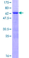 XPA Protein - 12.5% SDS-PAGE of human XPA stained with Coomassie Blue
