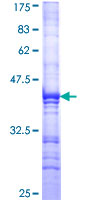 XPC Protein - 12.5% SDS-PAGE Stained with Coomassie Blue.