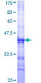 XPC Protein - 12.5% SDS-PAGE Stained with Coomassie Blue.