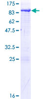 XPNPEP1 / Aminopeptidase P Protein - 12.5% SDS-PAGE of human XPNPEP1 stained with Coomassie Blue