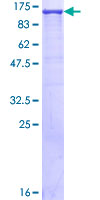 XPO1 / CRM1 Protein - 12.5% SDS-PAGE of human XPO1 stained with Coomassie Blue
