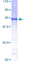 XPO5 / Exportin 5 Protein - 12.5% SDS-PAGE of human XPO5 stained with Coomassie Blue
