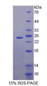 XPO5 / Exportin 5 Protein - Recombinant Exportin 5 (XPO5) by SDS-PAGE