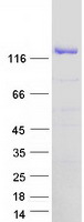 XPO5 / Exportin 5 Protein - Purified recombinant protein XPO5 was analyzed by SDS-PAGE gel and Coomassie Blue Staining