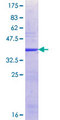 XPO6 Protein - 12.5% SDS-PAGE Stained with Coomassie Blue.