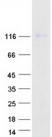 XPO6 Protein - Purified recombinant protein XPO6 was analyzed by SDS-PAGE gel and Coomassie Blue Staining