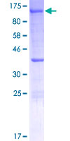 XPOT / Exportin-T Protein - 12.5% SDS-PAGE of human XPOT stained with Coomassie Blue