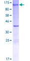 XPOT / Exportin-T Protein - 12.5% SDS-PAGE of human XPOT stained with Coomassie Blue
