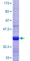 XPOT / Exportin-T Protein - 12.5% SDS-PAGE Stained with Coomassie Blue.