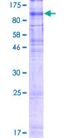 XPR1 Protein - 12.5% SDS-PAGE of human XPR1 stained with Coomassie Blue