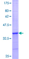 XPR1 Protein - 12.5% SDS-PAGE Stained with Coomassie Blue.