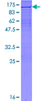 XRCC1 Protein - 12.5% SDS-PAGE of human XRCC1 stained with Coomassie Blue