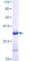 XRCC1 Protein - 12.5% SDS-PAGE Stained with Coomassie Blue.