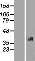 XRCC2 Protein - Western validation with an anti-DDK antibody * L: Control HEK293 lysate R: Over-expression lysate