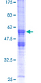 XRCC2 Protein - 12.5% SDS-PAGE of human XRCC2 stained with Coomassie Blue