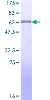 XRCC3 Protein - 12.5% SDS-PAGE of human XRCC3 stained with Coomassie Blue