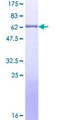 XRCC3 Protein - 12.5% SDS-PAGE of human XRCC3 stained with Coomassie Blue