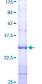 XRCC3 Protein - 12.5% SDS-PAGE Stained with Coomassie Blue.