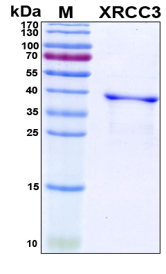 XRCC3 Protein