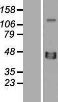 XRCC4 Protein - Western validation with an anti-DDK antibody * L: Control HEK293 lysate R: Over-expression lysate