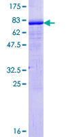 XRCC4 Protein - 12.5% SDS-PAGE of human XRCC4 stained with Coomassie Blue